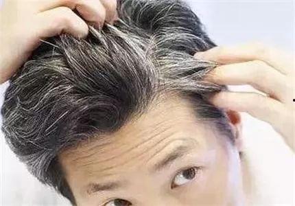 吃瓜爆料做头发技术好,吃瓜爆料，揭秘做头发技术高手背后的秘密