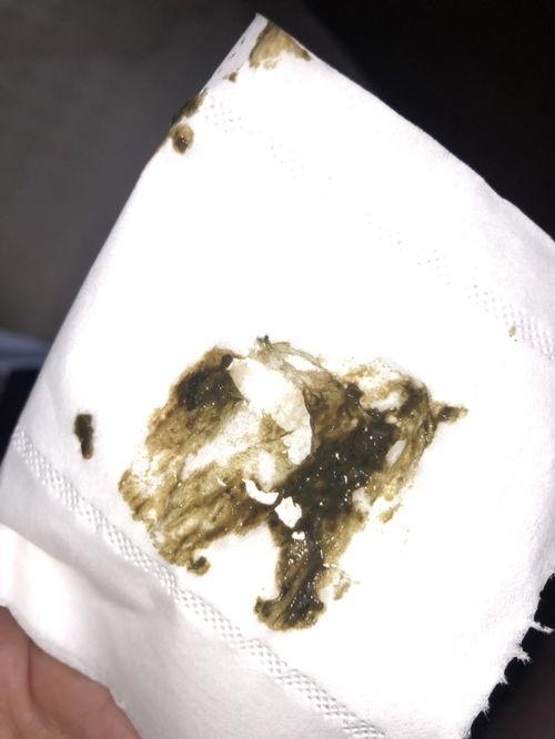 吃荀瓜大便黑吗,荀瓜食用后大便颜色变化揭秘