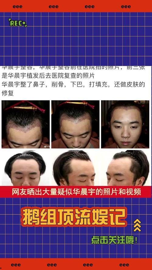 吃瓜爆料整容是真的吗